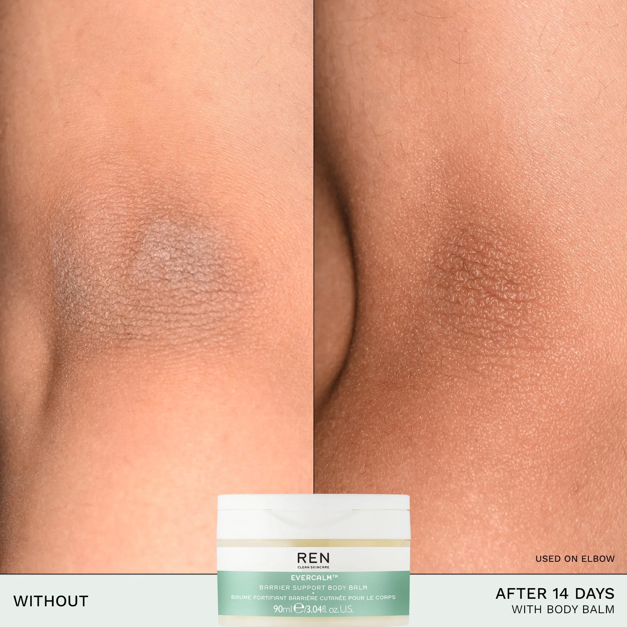 Evercalm™ Barrier Support Body Balm